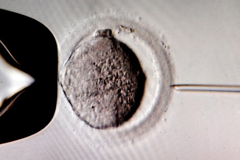 A monitor shows the microinjection of sperm into an egg cell using a microscope at a Leipzig, Germany, in vitro fertilisation clinic. Photo: CNS