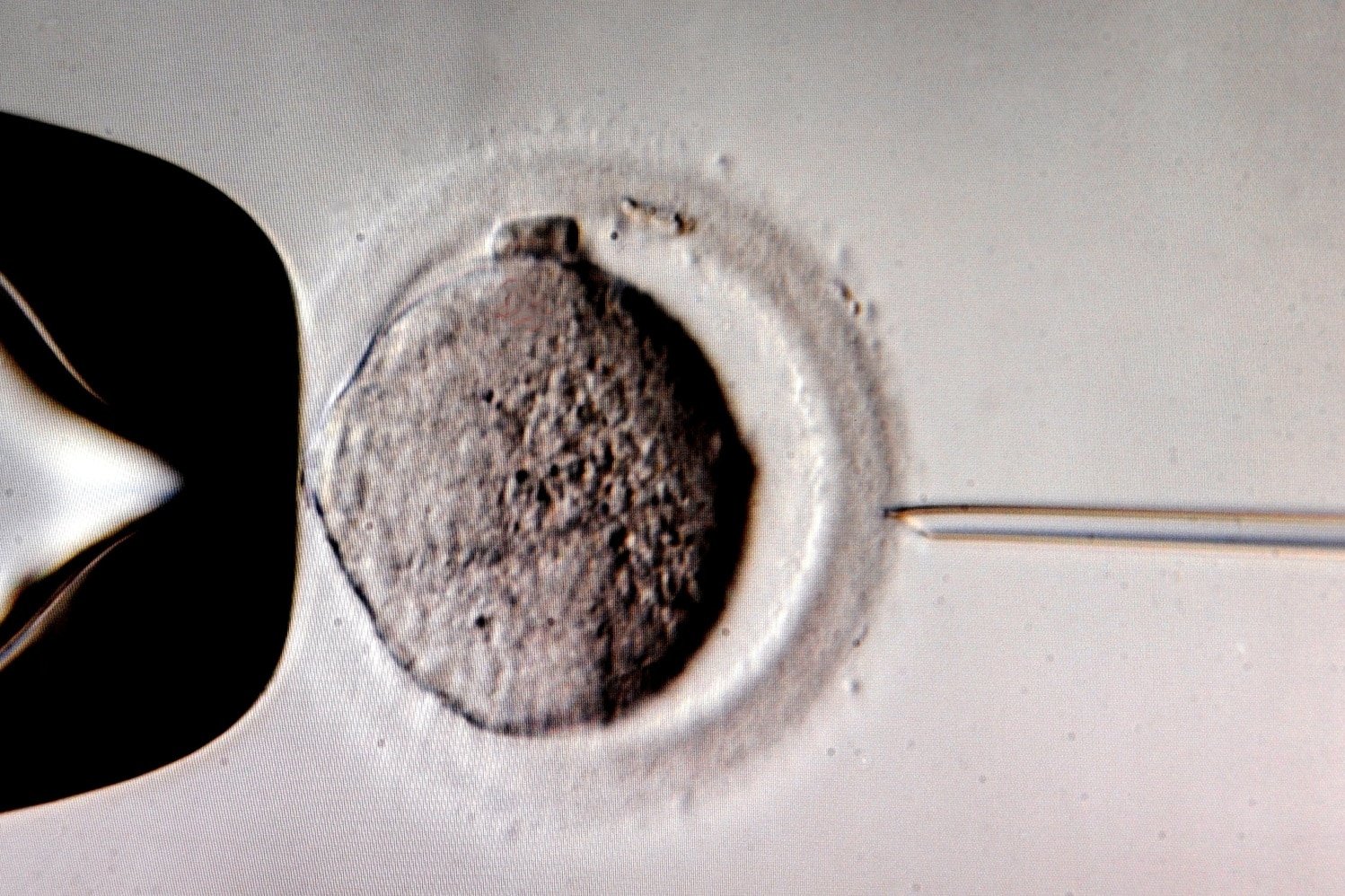 A monitor shows the microinjection of sperm into an egg cell using a microscope at a Leipzig, Germany, in vitro fertilization clinic in this July 2011 photo. Photo: CNS/EPA