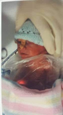 Ellie was born weighing 695 grams and measured 32cm long with a head circumference of 22.5cm. Photo: Supplied