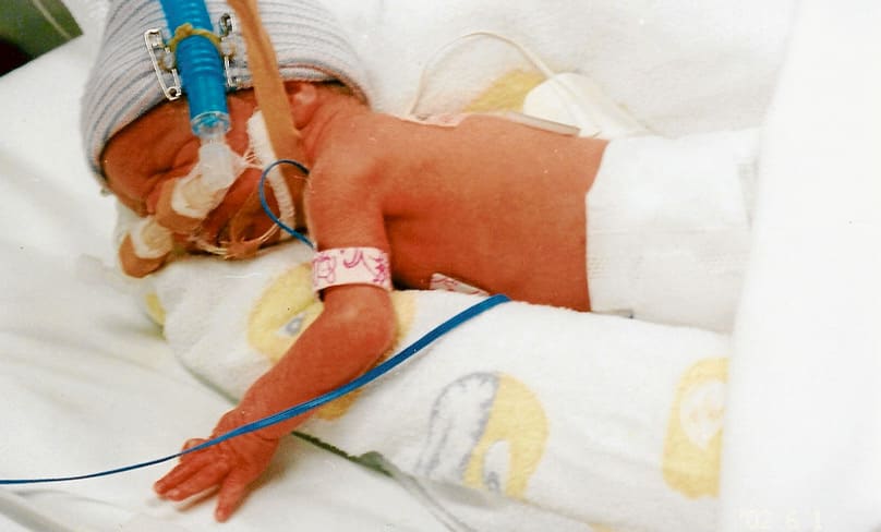 Veronica in Intensive Care after birth. Under NSW’s proposed legislation, she could have been killed.