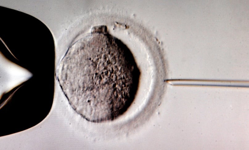 A monitor shows the microinjection of sperm into an egg cell using a microscope at a Leipzig, Germany, in vitro fertilization clinic in 2011. Photo: CNS photo/EPA